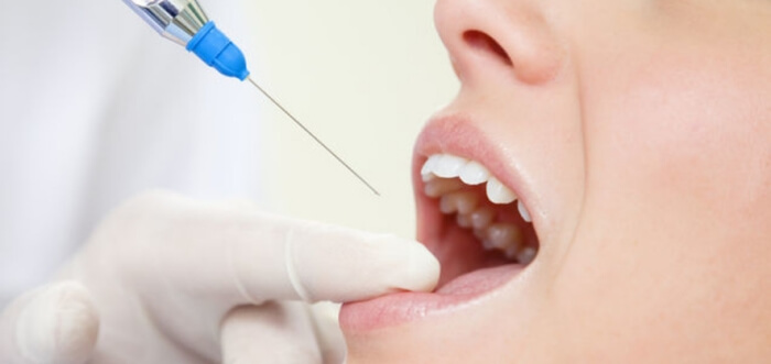 Dental Anaesthesia