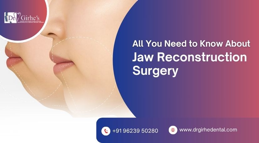 All You Need to know about Jaw Reconstruction Surgery
