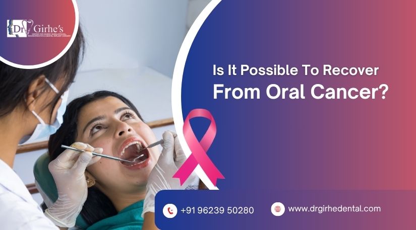 Is It Possible To Recover From Oral Cancer?