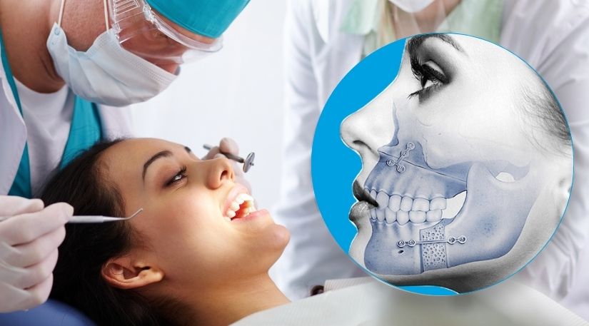 8 Healing Tips After Oral and Maxillofacial Surgery