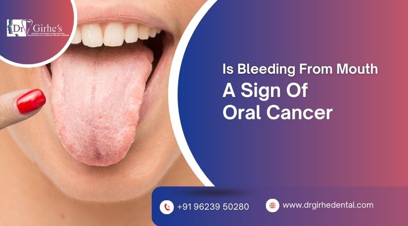 sign of oral cancer