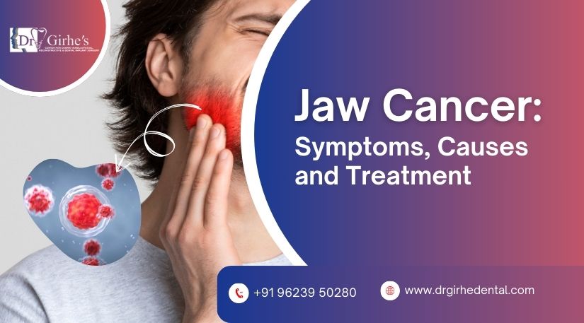 Jaw Cancer Symptoms Causes Treatment