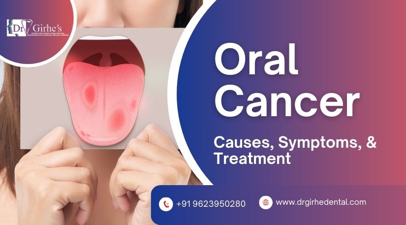 Oral Cancer Causes Symptoms Treatment