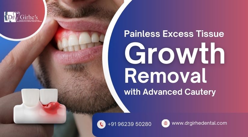Painless Excess Tissue Growth Removal with Advanced Cautery