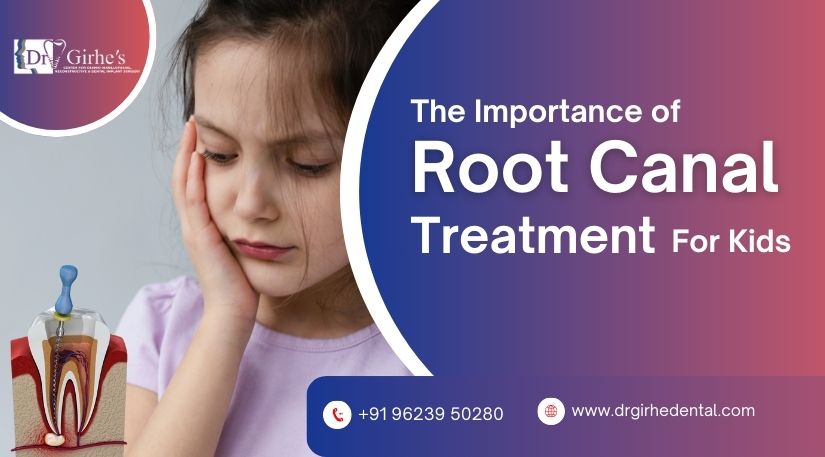 The Importance Of Root Canal Treatment For Kids