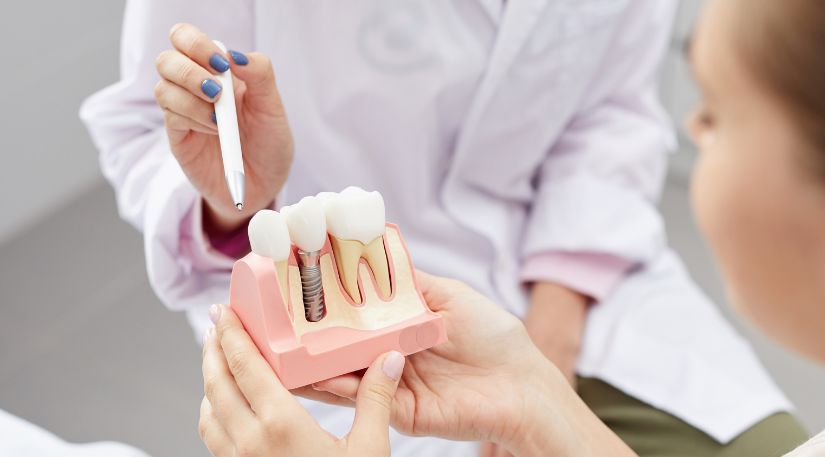 Tips For Finding High Quality And Affordable Dental Implants