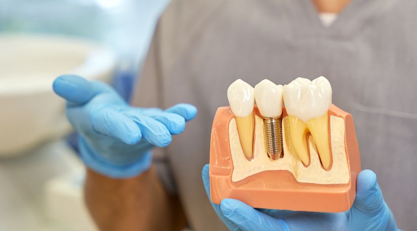 Ultimate Guide on Fixed Teeth in 72 Hours Costs Expectations and Benefits in Aurangabad