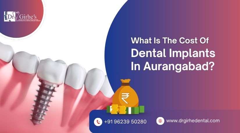 Cost of Dental Implants in Aurangabad
