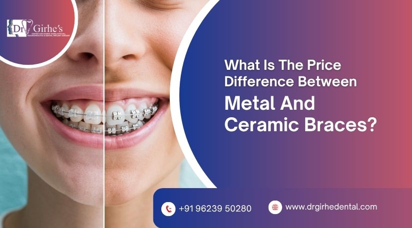 braces treatment cost in aurangabad